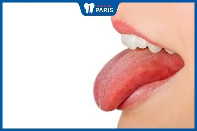Lưỡi khỏe mạnh không có màu sắc hay đốm bất thường