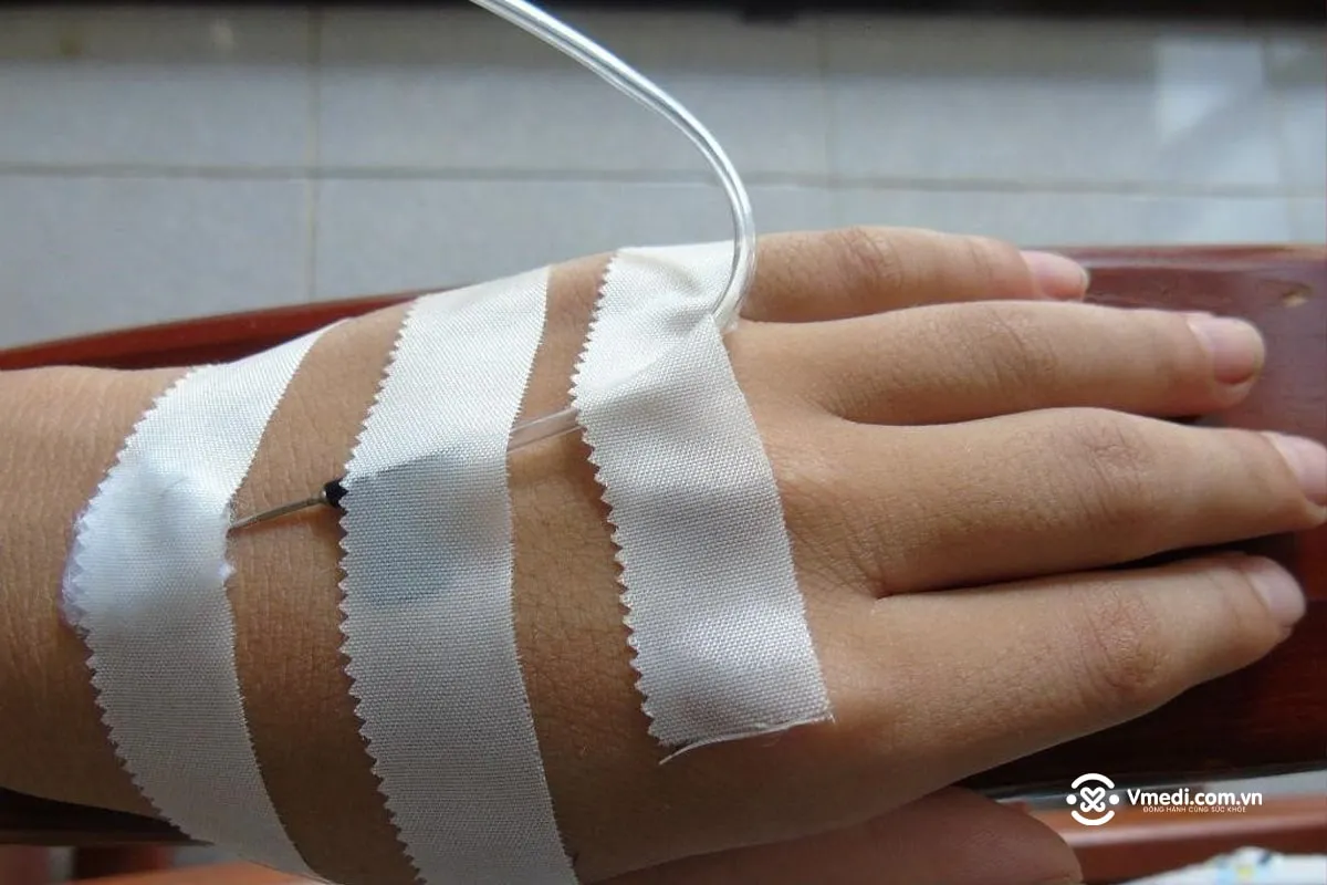 Bàn tay bệnh nhân truyền nước biển tĩnh mạch tại nhà