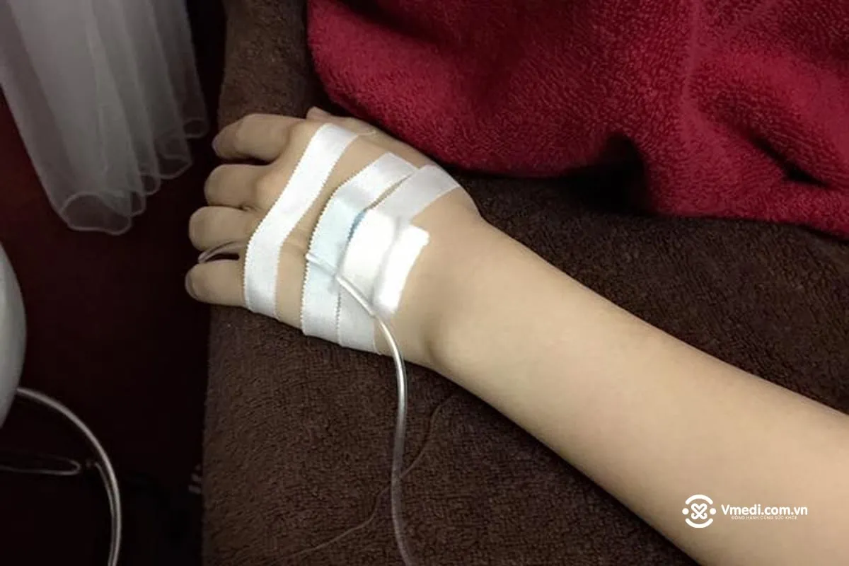 Góc nhìn từ trên xuống của cánh tay đang truyền nước tại phòng khách