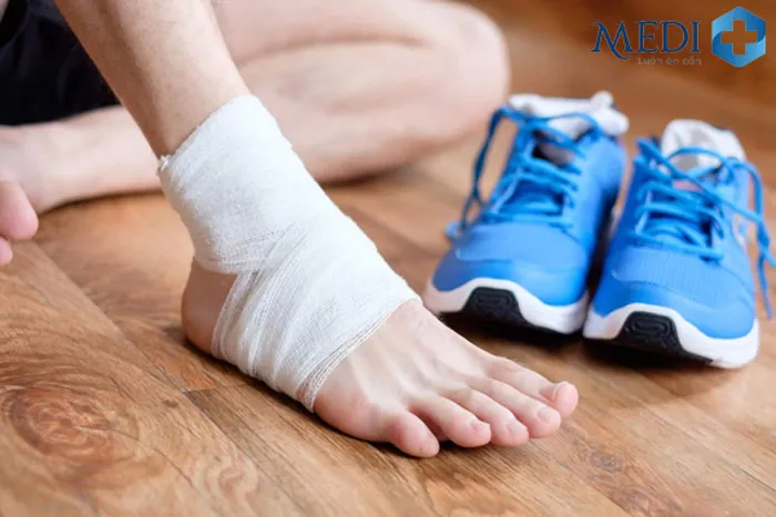 Hình ảnh băng cố định mu bàn chân giúp giảm đau