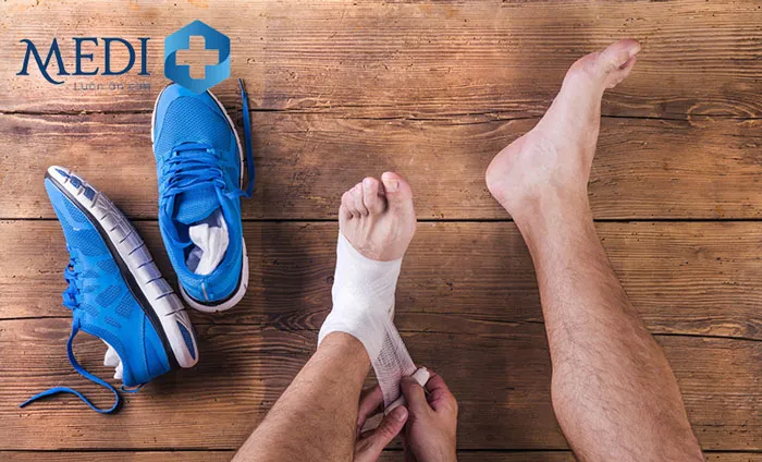 Hình ảnh đôi chân bị chèn ép do giày chật hoặc vận động quá mạnh